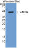 Tryptase Alpha/Beta 1 antibody, MBS2001502, MyBioSource, Western Blot image 