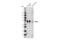 ABCG2 antibody, 42078T, Cell Signaling Technology, Western Blot image 