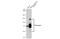 Fibrinogen Alpha Chain antibody, GTX135332, GeneTex, Western Blot image 