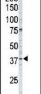 Casein Kinase 1 Alpha 1 antibody, PA5-14294, Invitrogen Antibodies, Western Blot image 