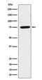 Lipoma-preferred partner antibody, M01240, Boster Biological Technology, Western Blot image 