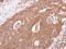 Adrenoceptor Beta 2 antibody, NBP2-15564, Novus Biologicals, Immunohistochemistry paraffin image 