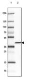 ADP-Ribosylhydrolase Like 1 antibody, NBP2-39073, Novus Biologicals, Western Blot image 