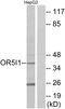 Olfactory Receptor Family 5 Subfamily I Member 1 antibody, GTX87393, GeneTex, Western Blot image 