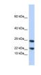 Lipocalin 8 antibody, NBP1-56314, Novus Biologicals, Western Blot image 