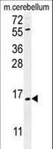 Ankyrin Repeat Domain 39 antibody, LS-C156369, Lifespan Biosciences, Western Blot image 