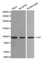 Valosin Containing Protein antibody, STJ110914, St John