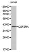 Colony Stimulating Factor 2 Receptor Alpha Subunit antibody, abx002270, Abbexa, Western Blot image 