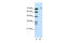 TATA-Box Binding Protein Associated Factor 6 antibody, 28-913, ProSci, Western Blot image 