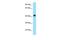 Arylacetamide Deacetylase Like 3 antibody, GTX16548, GeneTex, Western Blot image 