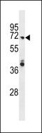 Rho GTPase Activating Protein 40 antibody, LS-C159108, Lifespan Biosciences, Western Blot image 