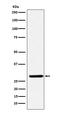 Four And A Half LIM Domains 2 antibody, M02129-1, Boster Biological Technology, Western Blot image 