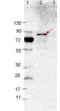 Outer surface protein VlsE antibody, orb344689, Biorbyt, Western Blot image 