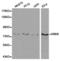 Inhibitor Of Nuclear Factor Kappa B Kinase Subunit Beta antibody, TA327264, Origene, Western Blot image 