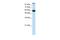 General Transcription Factor IIIC Subunit 5 antibody, A12539, Boster Biological Technology, Western Blot image 