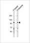 KGFR antibody, GTX81342, GeneTex, Western Blot image 