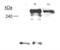 Neurofibromin 1 antibody, NB300-153, Novus Biologicals, Western Blot image 