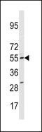 Cytochrome P450(scc) antibody, 63-278, ProSci, Western Blot image 