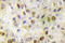 RAR Related Orphan Receptor A antibody, LS-C176905, Lifespan Biosciences, Immunohistochemistry paraffin image 