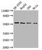 Solute Carrier Family 19 Member 3 antibody, LS-C681351, Lifespan Biosciences, Western Blot image 