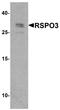 R-Spondin 3 antibody, A05387, Boster Biological Technology, Western Blot image 