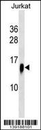 ATPase H+ Transporting V1 Subunit F antibody, 60-349, ProSci, Western Blot image 