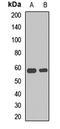 UDP-N-Acetylglucosamine Pyrophosphorylase 1 antibody, LS-C668228, Lifespan Biosciences, Western Blot image 