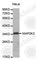 Mitogen-Activated Protein Kinase Kinase 3 antibody, A0513, ABclonal Technology, Western Blot image 