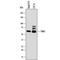 Checkpoint Kinase 2 antibody, MAB22851, R&D Systems, Western Blot image 