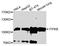 Inositol-Trisphosphate 3-Kinase B antibody, STJ24265, St John