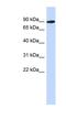 Phosphoglucomutase 2 Like 1 antibody, NBP1-56592, Novus Biologicals, Western Blot image 