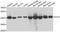 Glutamic-Oxaloacetic Transaminase 2 antibody, A6915, ABclonal Technology, Western Blot image 
