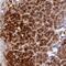 AE Binding Protein 2 antibody, NBP2-30712, Novus Biologicals, Immunohistochemistry paraffin image 