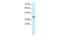 General Transcription Factor IIH Subunit 3 antibody, GTX77809, GeneTex, Western Blot image 