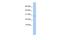 Ankyrin repeat domain-containing protein 7 antibody, A16771, Boster Biological Technology, Western Blot image 