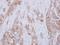 Diphthamide Biosynthesis 2 antibody, NBP2-16218, Novus Biologicals, Immunohistochemistry paraffin image 