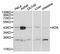 Adenosine Deaminase antibody, orb129504, Biorbyt, Western Blot image 