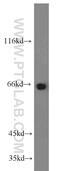 Parathyroid Hormone 2 Receptor antibody, 14166-1-AP, Proteintech Group, Western Blot image 