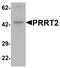 Proline Rich Transmembrane Protein 2 antibody, PA5-34537, Invitrogen Antibodies, Western Blot image 
