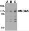 Interferon Induced With Helicase C Domain 1 antibody, 4039, ProSci, Western Blot image 