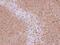 Nuclear Receptor Coactivator 3 antibody, NBP1-33720, Novus Biologicals, Immunohistochemistry paraffin image 