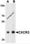 C-X-C Motif Chemokine Receptor 3 antibody, 7647, ProSci, Western Blot image 