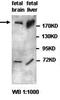 SOS Ras/Rac Guanine Nucleotide Exchange Factor 1 antibody, orb76898, Biorbyt, Western Blot image 