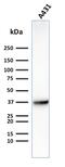 Solute Carrier Family 2 Member 1 antibody, GTX17986, GeneTex, Western Blot image 