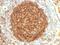 Complement C3b/C4b Receptor 1 (Knops Blood Group) antibody, GTX34504, GeneTex, Immunohistochemistry paraffin image 