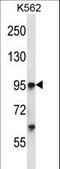 Tyrosine Kinase With Immunoglobulin Like And EGF Like Domains 1 antibody, LS-C164590, Lifespan Biosciences, Western Blot image 