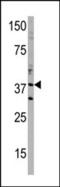 DIMT1 RRNA Methyltransferase And Ribosome Maturation Factor antibody, 60-554, ProSci, Western Blot image 