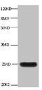 Lipocalin 2 antibody, CSB-MA068302A0m, Cusabio, Western Blot image 