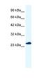 RNA Transcription, Translation And Transport Factor antibody, orb324544, Biorbyt, Western Blot image 