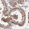 Ring Finger Protein 139 antibody, HPA001202, Atlas Antibodies, Immunohistochemistry frozen image 